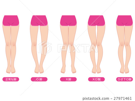 Distortion of O leg legal pelvis 27971461