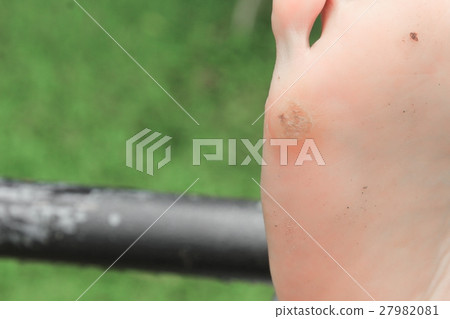 foot corn :Select focus with shallow depth of field. 27982081