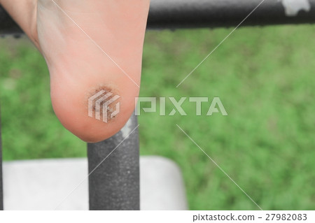 foot corn :Select focus with shallow depth of field. 27982083
