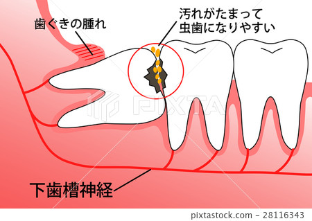 Wisdom Teeth Empire 28116343