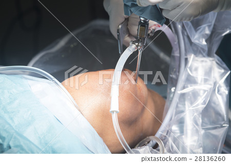 Knee surgery hospital operation Knee surgery hospital operation 28136260