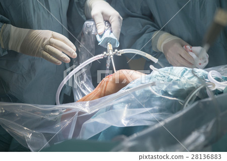 Knee surgery hospital operation Knee surgery hospital operation 28136883
