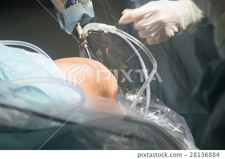 Knee surgery hospital operation Knee surgery hospital operation 28136884
