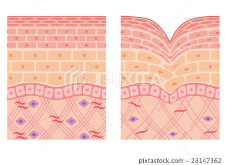 Structural cross section of wrinkle skin Structural cross section of wrinkle skin 28147362