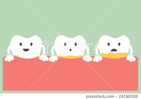 periodontal disease with plaque or tartar periodontal disease with plaque or tartar 28190588