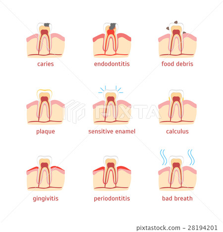Cartoon Dental Problems Set . Vector 28194201