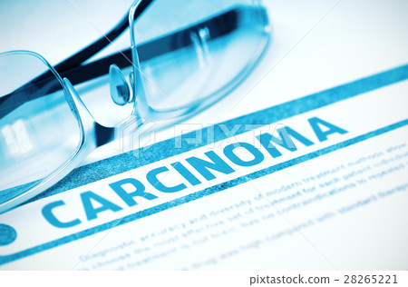Carcinoma. Medicine. 3D Illustration. Carcinoma. Medicine. 3D Illustration. 28265221