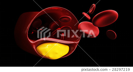 3d Illustration of blood cells with plaque buildup 3d Illustration of blood cells with plaque buildup 28297219