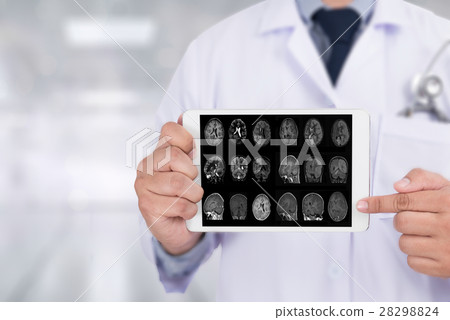 Alzheimers Disease concept , Brain degenerative Alzheimers Disease concept , Brain degenerative 28298824