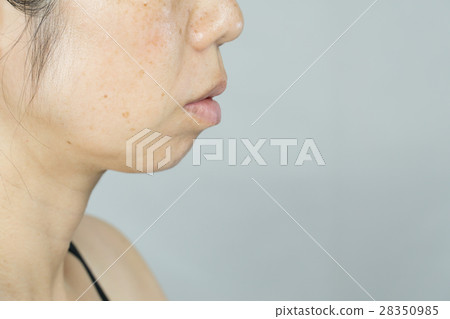中年女士患有旋轉無妝，雀斑，間諜射線 28350985
