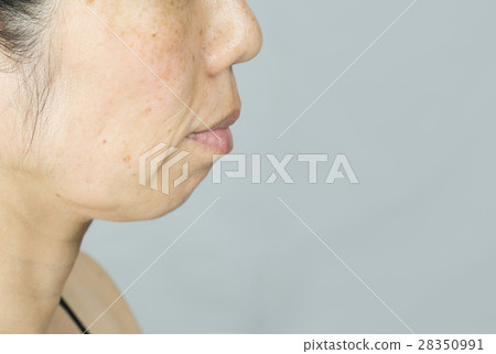 中年女士患有旋轉無妝，雀斑，間諜射線 28350991