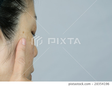 Women suffering from spotless no-makeup and freckles 28354196