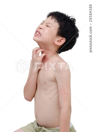 Young asian boy scratching his allergic skin 28384388