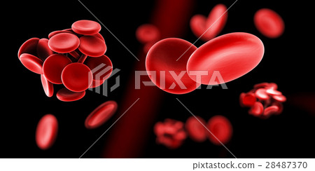 Blood clot and thrombosis medical 3d illustration 28487370