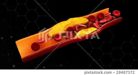 3d Illustration of blood cells with plaque buildup 28487372