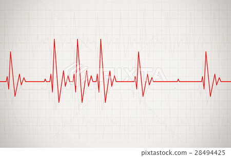 Irregular Heartbeat Illustration 28494425