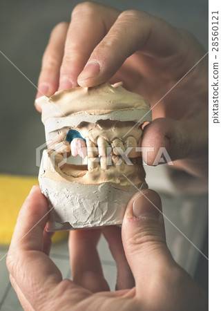 Dental Prosthesis 28560121