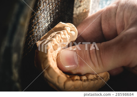 Dental Prosthesis Dental Prosthesis 28598684