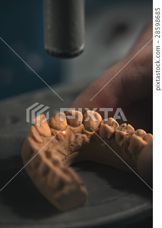 Dental Prosthesis Dental Prosthesis 28598685