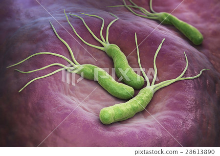 Helicobacter Pylori bacteria 28613890