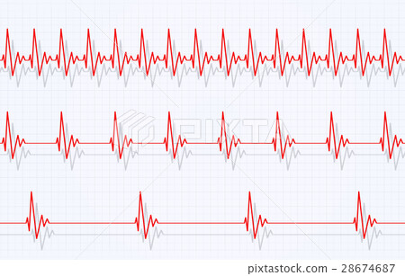 Speed of Heart beating - Stock Illustration [28674687] - PIXTA