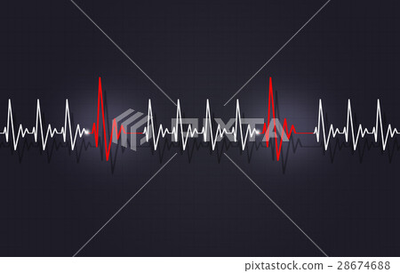 Tachycardia with Arrythmia 28674688
