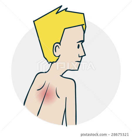 Scoliosis and back problems 28675321