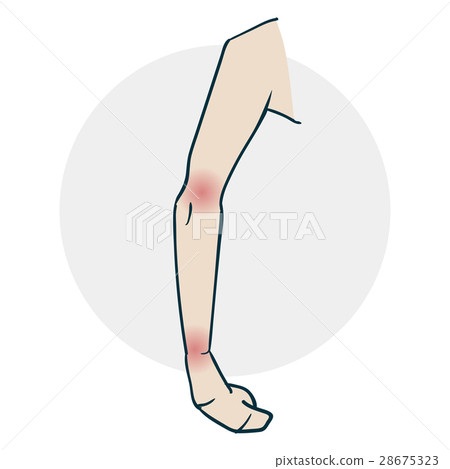 Problems with the limb joints Problems with the limb joints 28675323