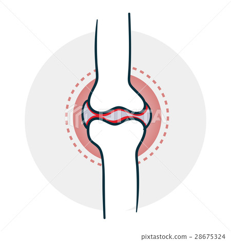 Problems with joints Problems with joints 28675324