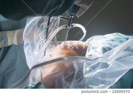 Knee surgery hospital operation Knee surgery hospital operation 28806970