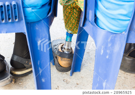 asian old woman with aluminium prostheses 28965925