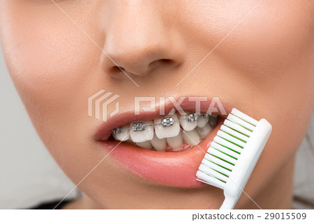 Beautiful young woman with teeth braces 29015509