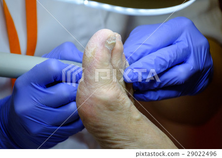 Pedicure specialist works with the patient Pedicure specialist works with the patient 29022496