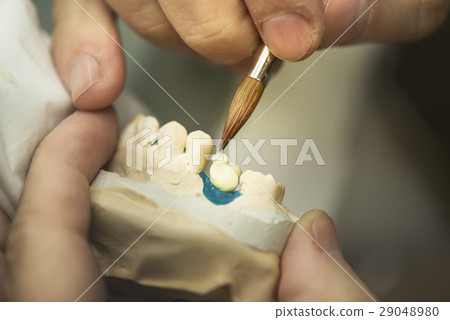 Dental Prosthesis 29048980