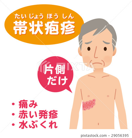 Symptoms of shingles Symptoms of shingles 29056395