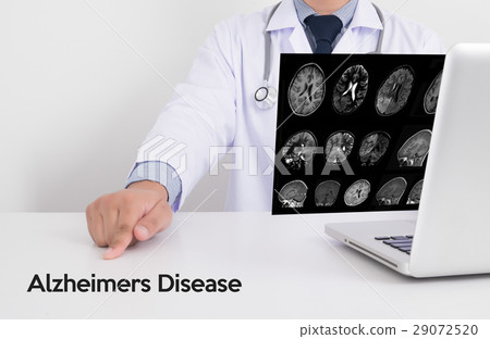 Alzheimers Disease concept , Brain degenerative Alzheimers Disease concept , Brain degenerative 29072520