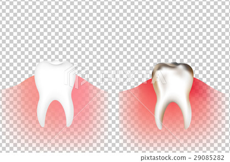 Tooths 29085282