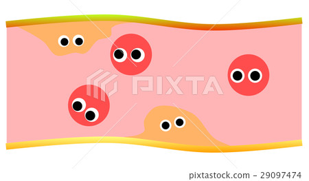 Blood vessel - Stock Illustration [29097474] - PIXTA