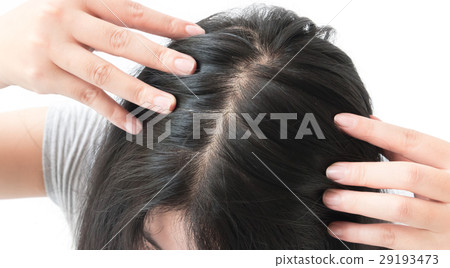 Woman serious hair loss problem 29193473