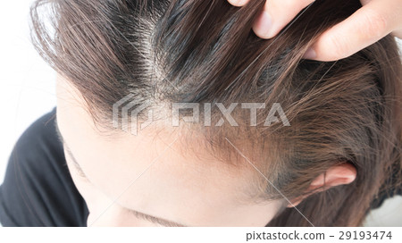 Closeup woman hand itchy scalp, Hair care concept 29193474