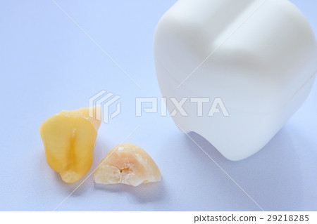 Wisdom Teeth Headless and Root Vertical Preservation Case Light Blue Back 29218285