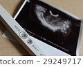 pregnancy 29249717