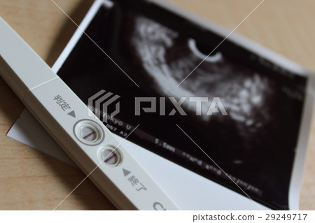 pregnancy 29249717