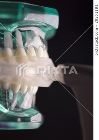 Vibrating dental device with invisible Vibrating dental device with invisible 29251191