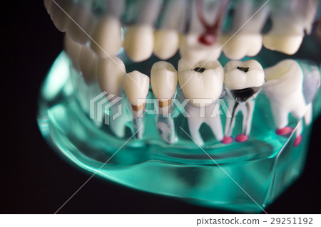 Denture for dentistry students 29251192