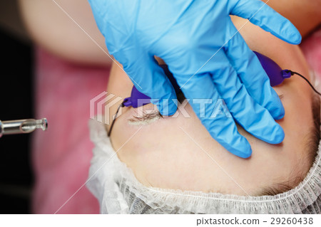 Laser removal of tattoo eyebrows 29260438