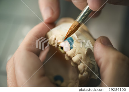 Dental Prosthesis Dental Prosthesis 29284100