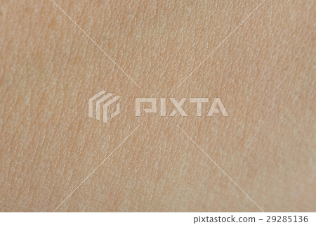 Cells on human skin 29285136