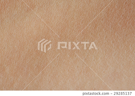 cells on human skin 29285137