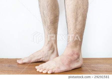 毛腿 毛腿 29291581